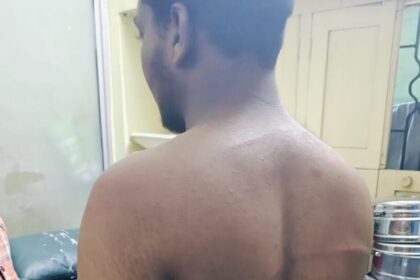 వారంగల్ నేరం: అమ్మాయికి అమ్మాయికి ఉద్యోగం చూపించినందుకు దారుణం, వరంగల్ లో యువకుడిపై కర్రలు కర్రలు, బెల్టుతో బెల్టుతో బెల్టుతో